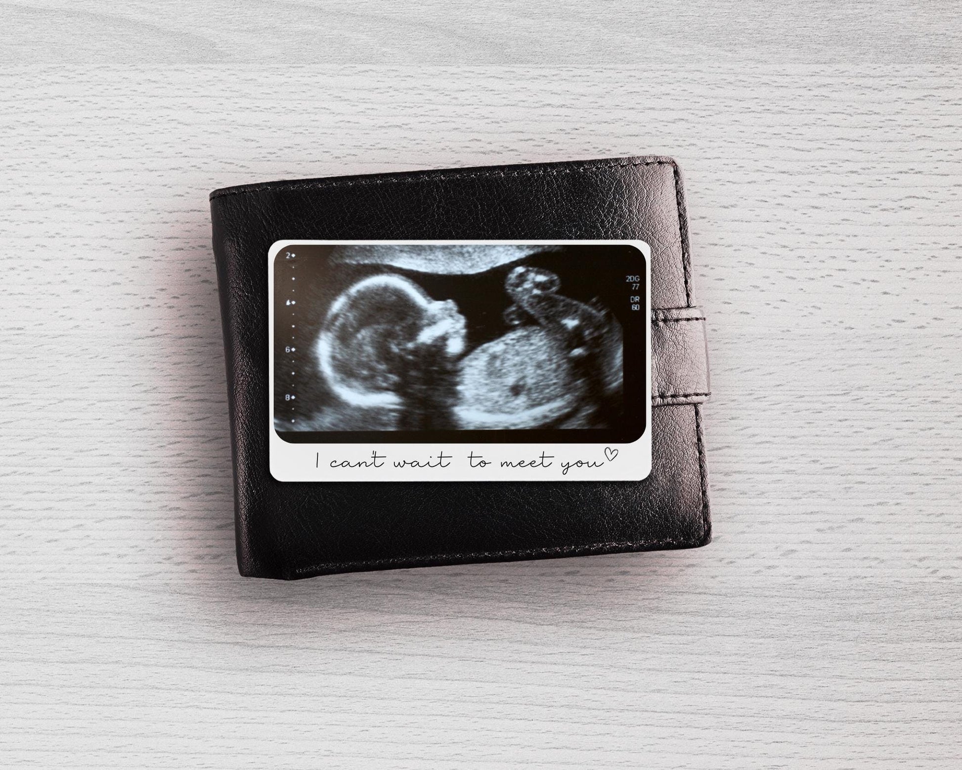 Photo Wallet Card Personalised Baby Scan Ultrasound Gift For Daddy Grandparents Pregnancy Reveal Announcement